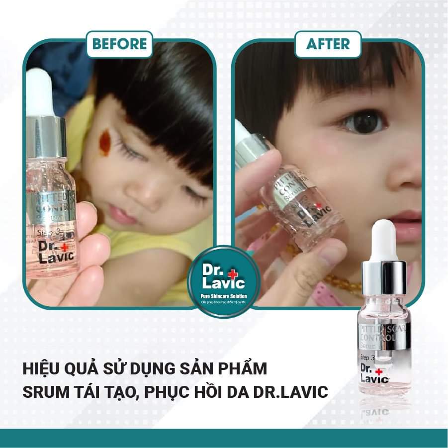 Serum tái tạo da - step3 Dr.lavic