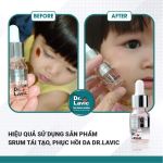 Serum tái tạo da - step3 Dr.lavic